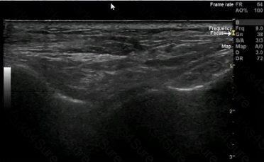 RhMSUS Question 19